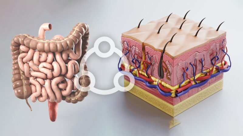 The-Gut-Skin-Connection-in-Common-Skin-Conditions