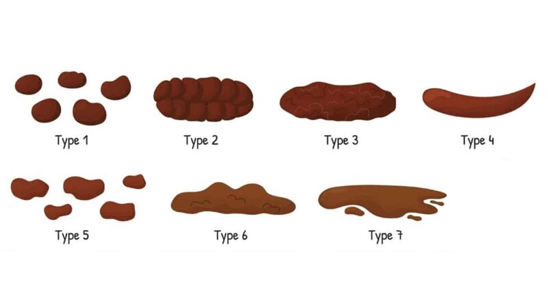 The Seven Types of Stool