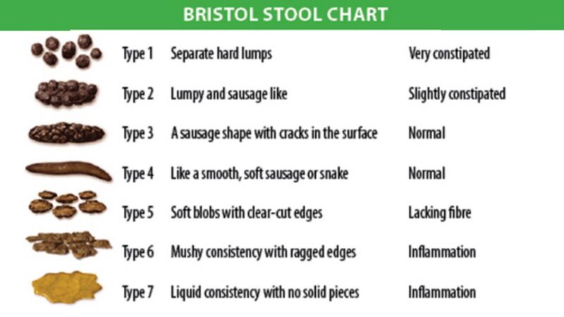 What Is the Bristol Stool Chart