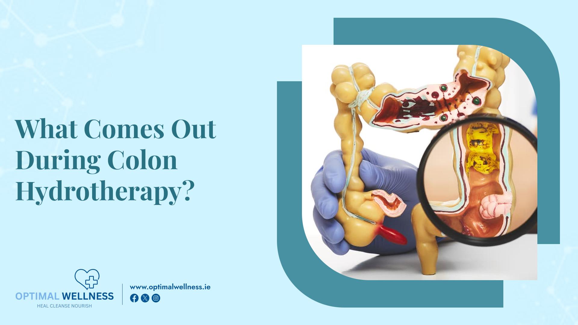 What Comes Out During Colon Hydrotherapy